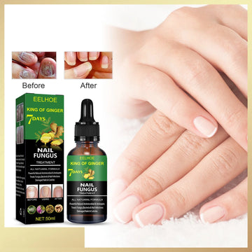 7 Days Nail Fungus Essence Hand and Foot Care Serum Removal Repair Gel Anti-Infection