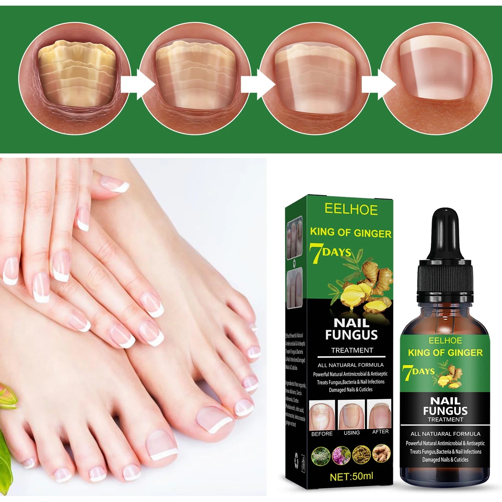 7 Days Nail Fungus Essence Hand and Foot Care Serum Removal Repair Gel Anti-Infection