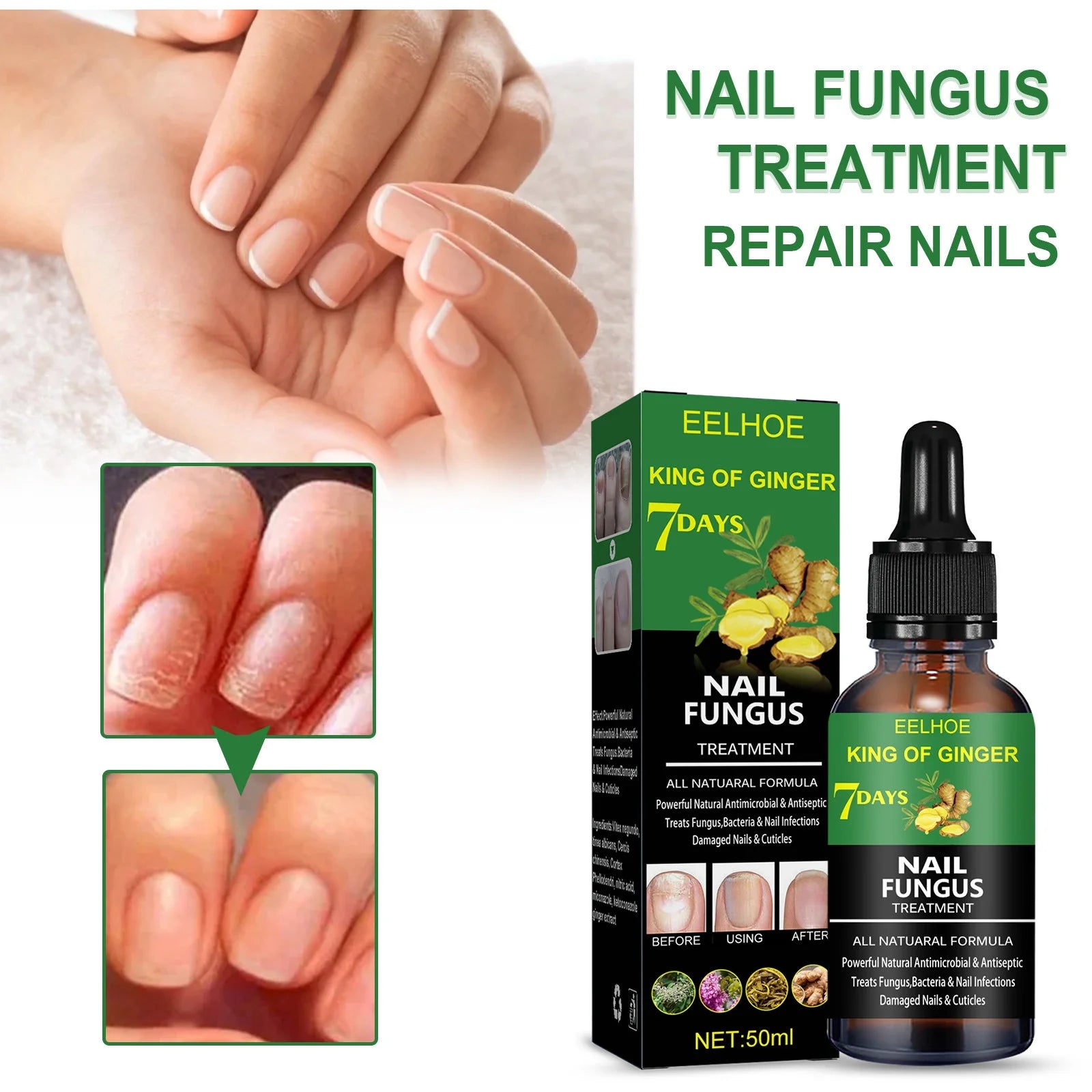 7 Days Nail Fungus Essence Hand and Foot Care Serum Removal Repair Gel Anti-Infection